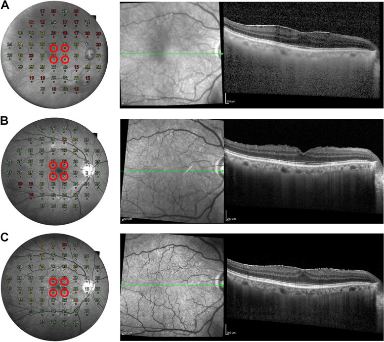 Fig. 3