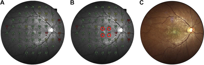 Fig. 1