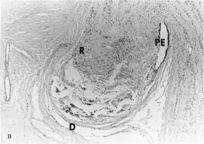 FIGURE 3 B