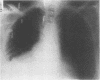 230