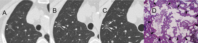 Figure 4