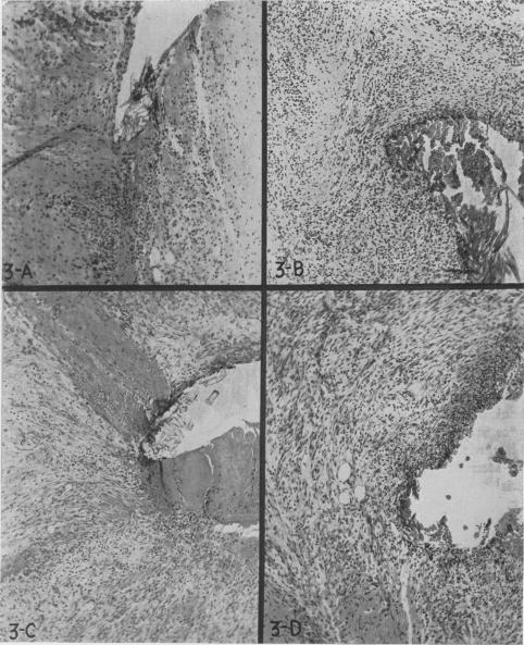 Fig. 3 A, B, C, D.