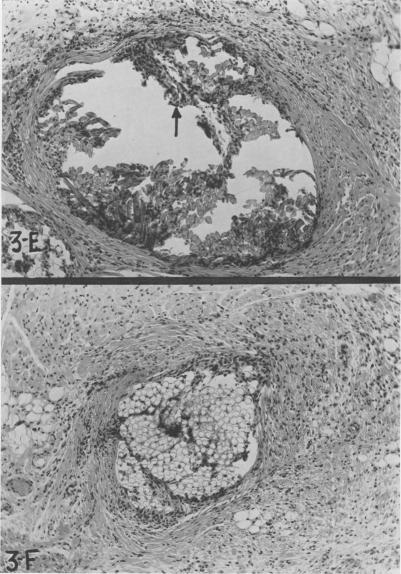 Fig. 3 E, F.