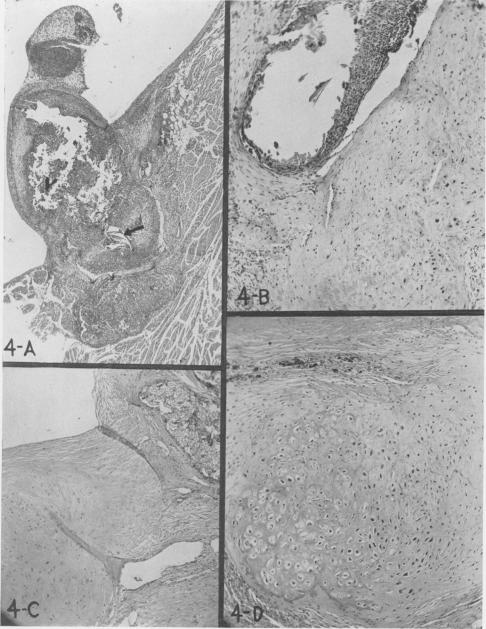 Fig. 4 A, B, C, D.