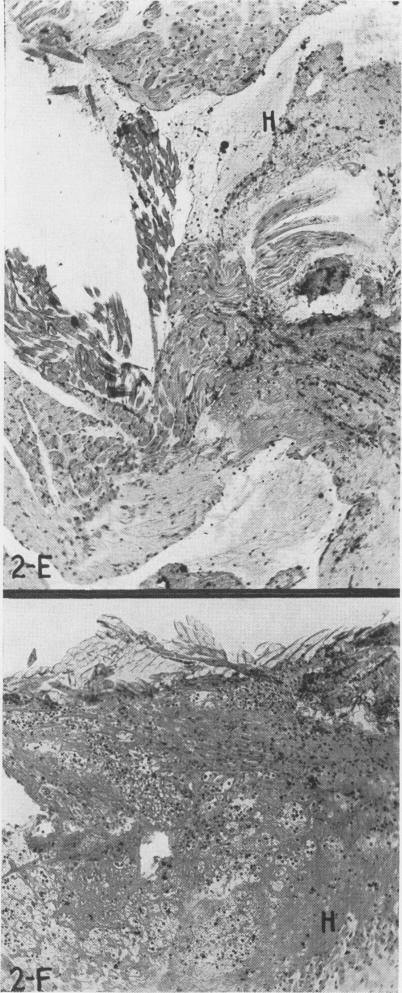 Fig. 2 E, F.