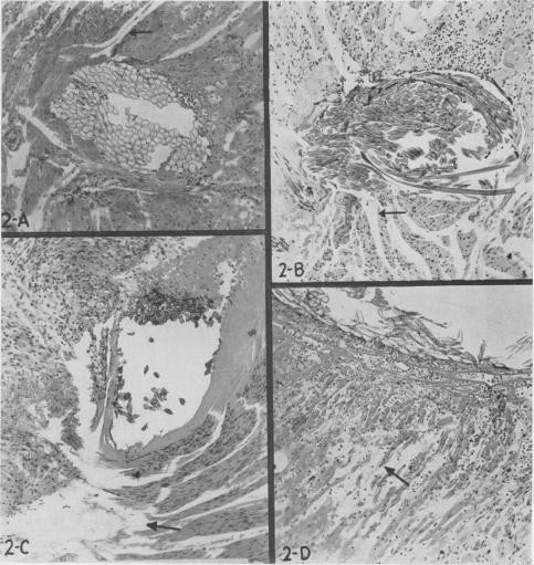 Fig. 2 A, B, C, D.