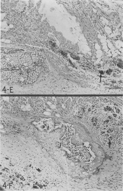 Fig. 4 E, F.