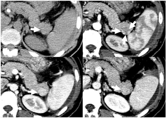 Fig. 5