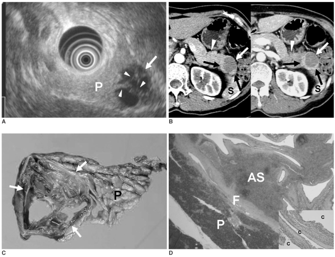 Fig. 11