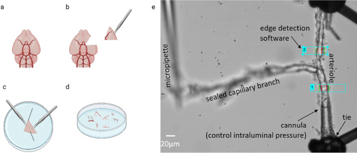 FIGURE 1