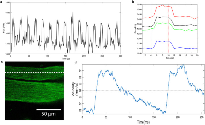 FIGURE 3