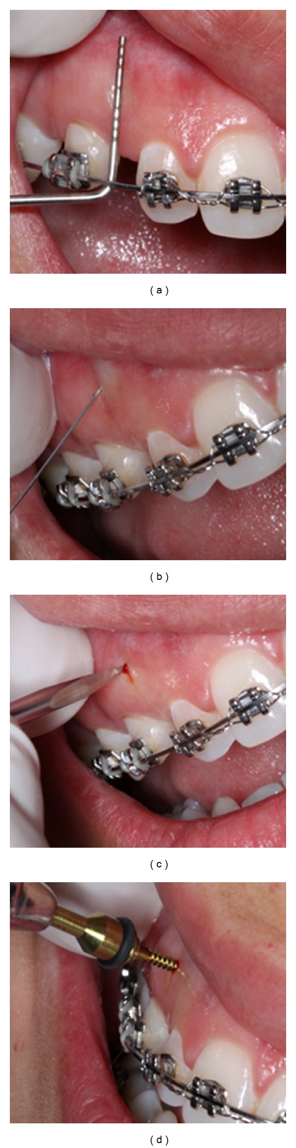 Figure 4