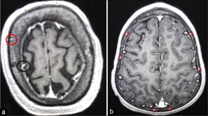 Figure 2: