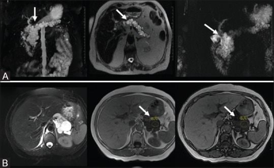 Figure 13(A and B)