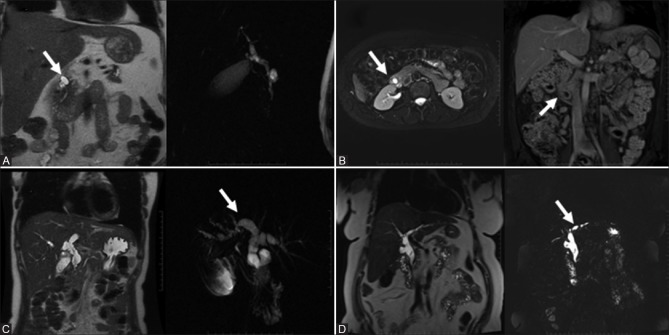 Figure 2(A-D)