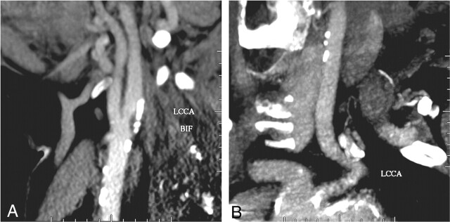 Fig 3.