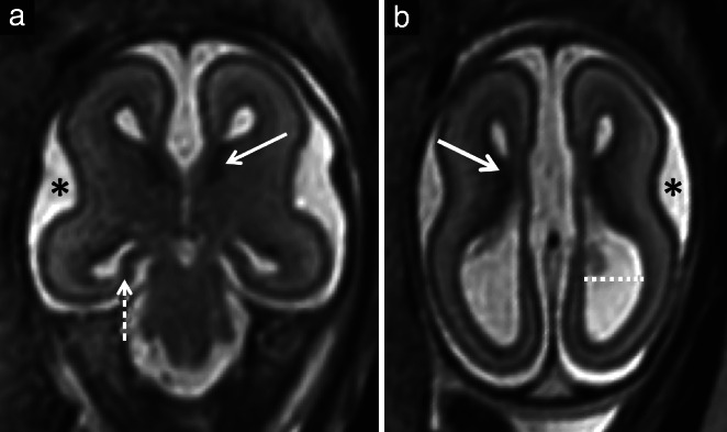 UOG-22102-FIG-0004-b