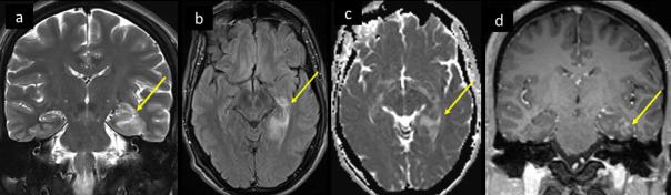 Figure 12.