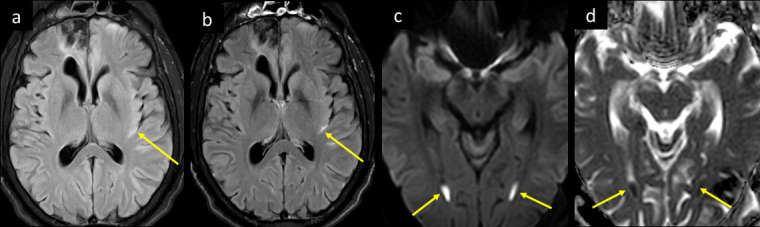 Figure 14.