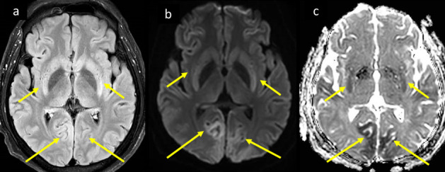 Figure 10.