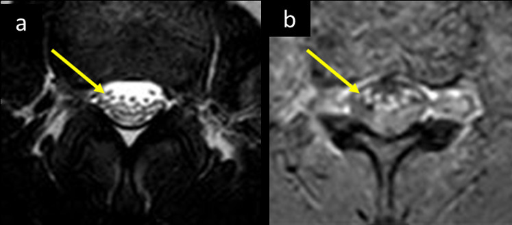 Figure 16.