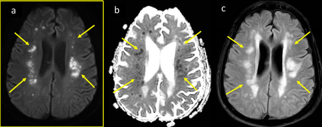 Figure 9.