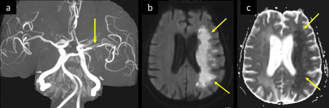 Figure 11.