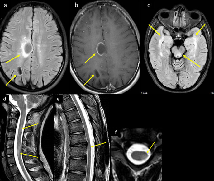 Figure 15.