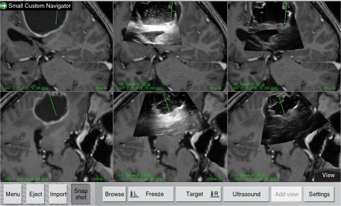 Fig. 2