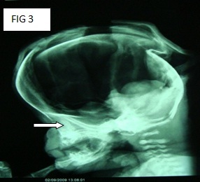 [Table/Fig-6]: