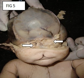 [Table/Fig-3]: