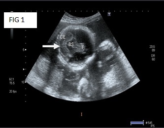 [Table/Fig-1]: