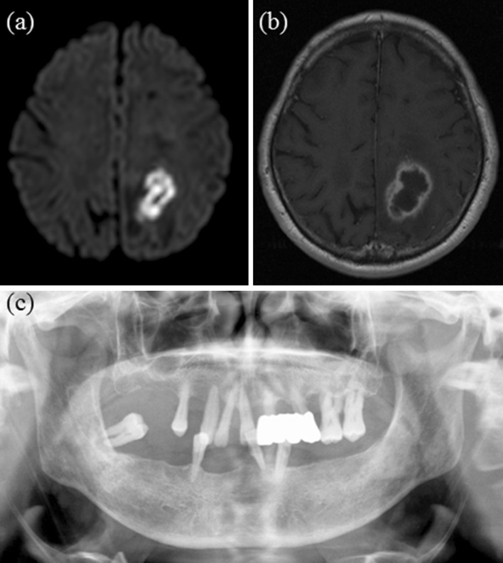 Fig. 2