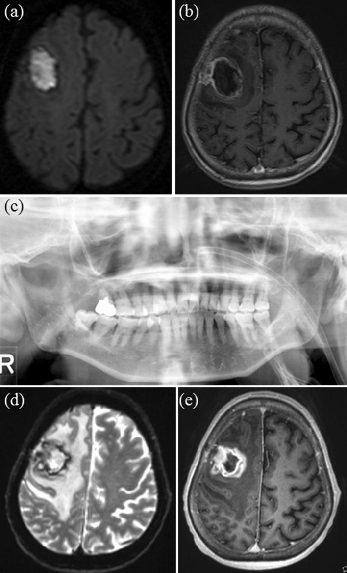 Fig. 3