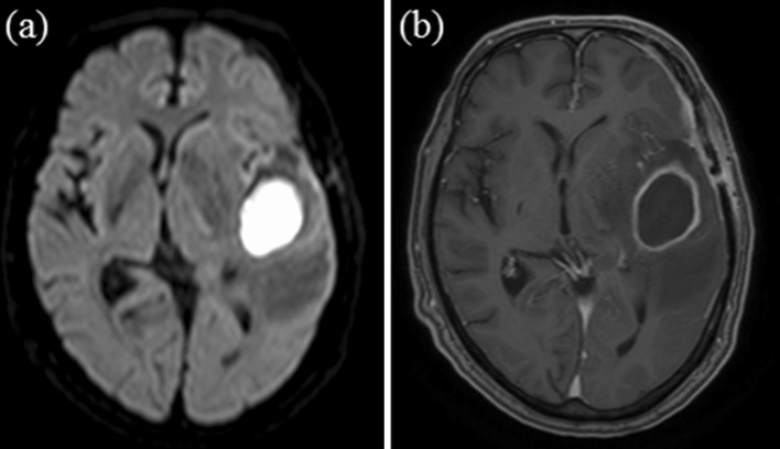 Fig. 1