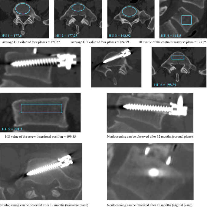 Fig. 4