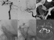 Fig.4