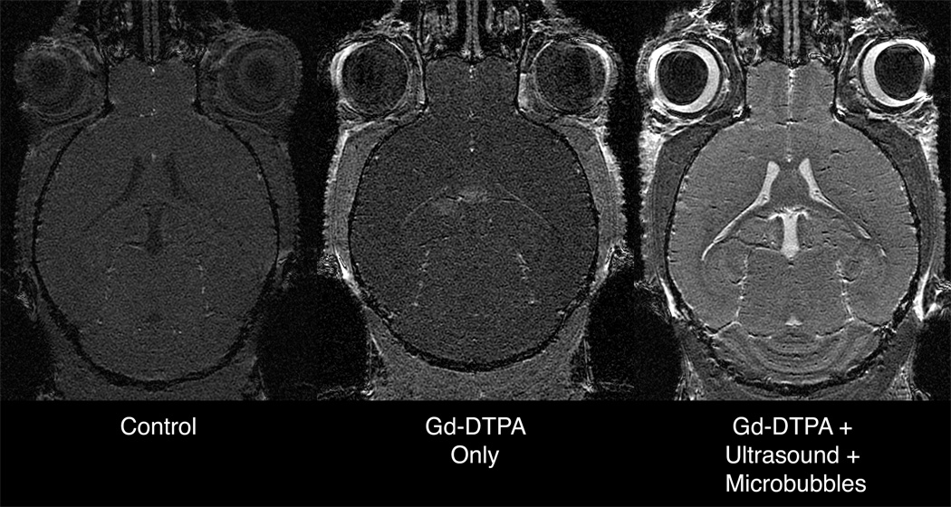 FIG. 9