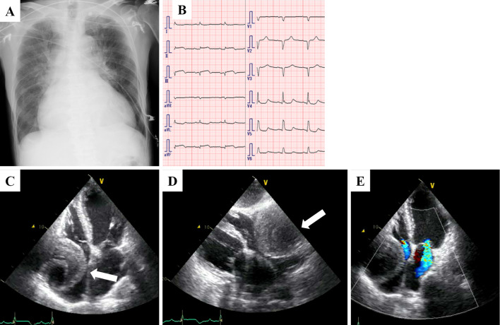 Figure 1.