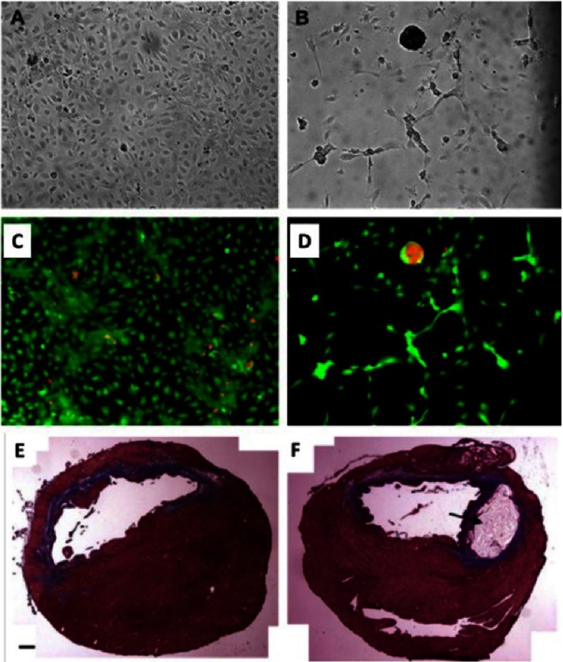 Figure 11.