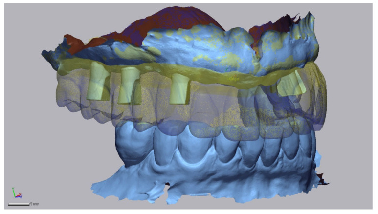 Figure 10