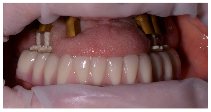 Figure 15