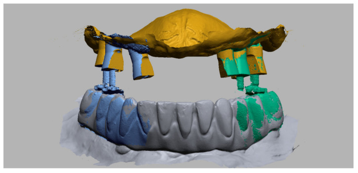 Figure 16