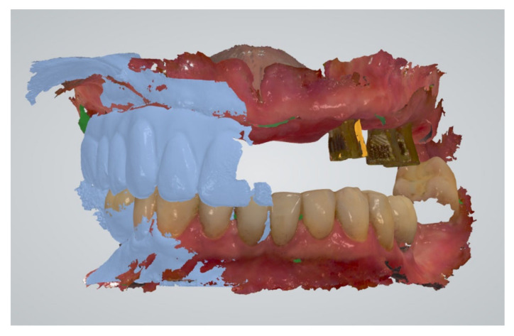 Figure 5