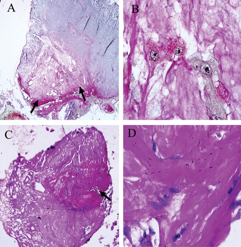 Fig 6