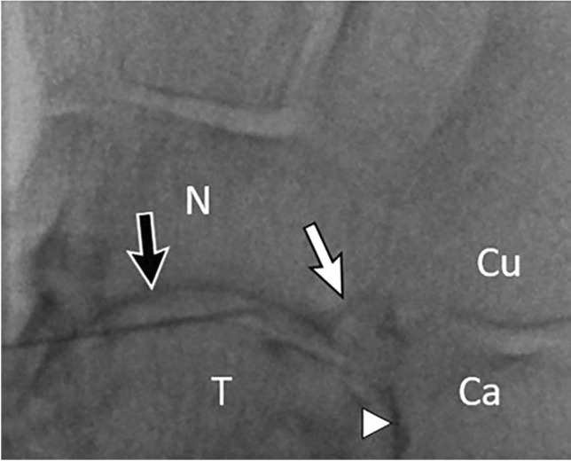 Fig. 25