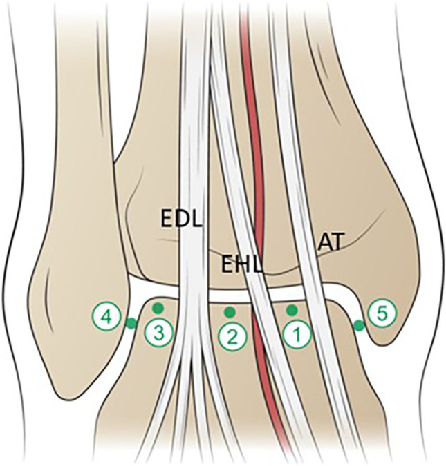 Fig. 16