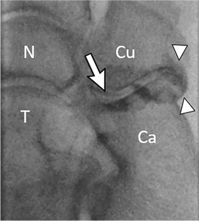 Fig. 26