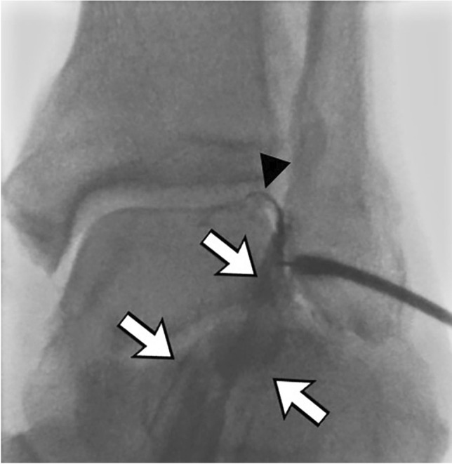 Fig. 18