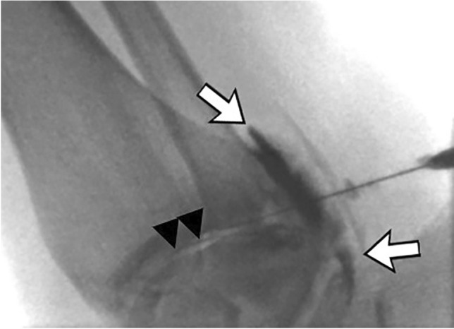 Fig. 19